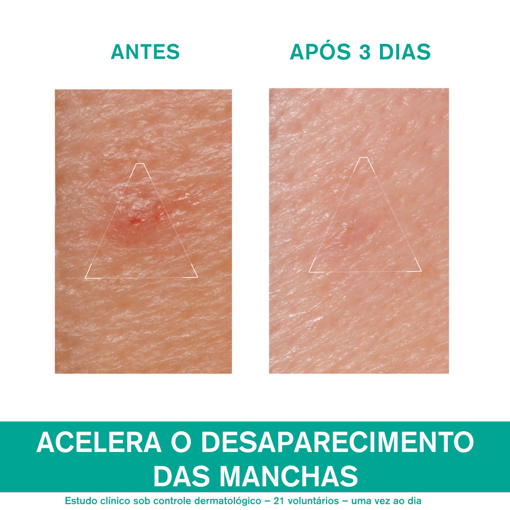 Uriage Hyséac Pasta SOS 15g