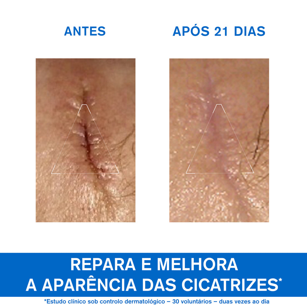 Uriage Bariéderm-Cica Creme 100ml