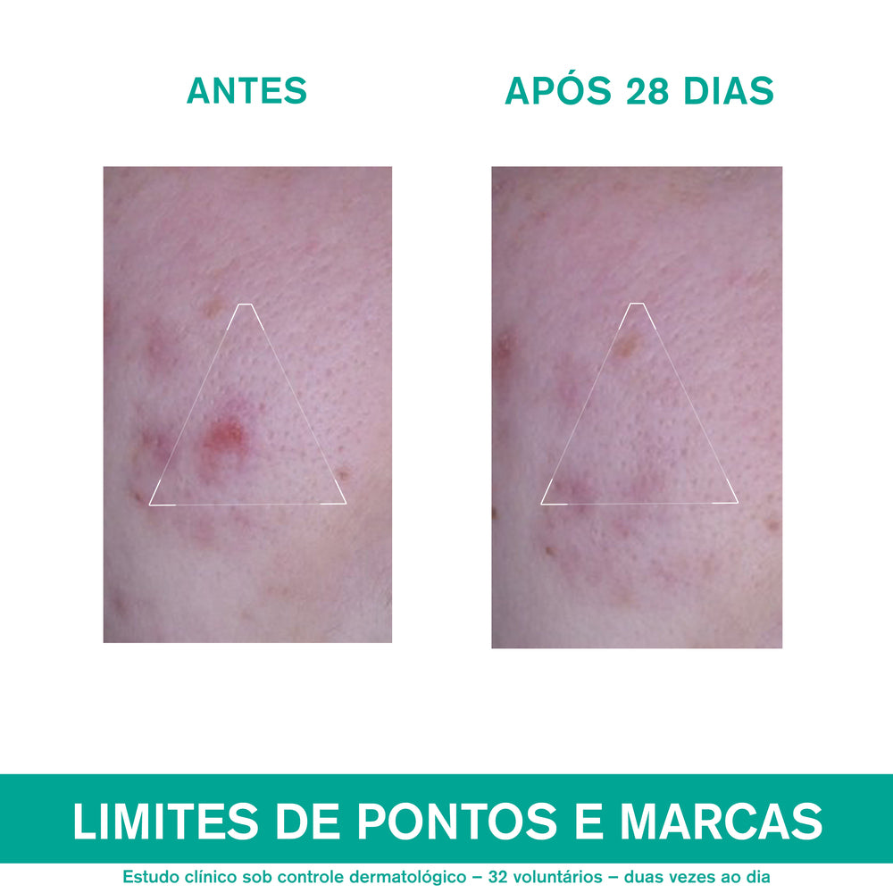 Uriage Hyséac 3-Regul+ Cuidado Global Anti-Imperfeições 40ml